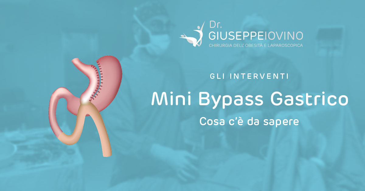 Mini Bypass Gastrico Giuseppe Iovino