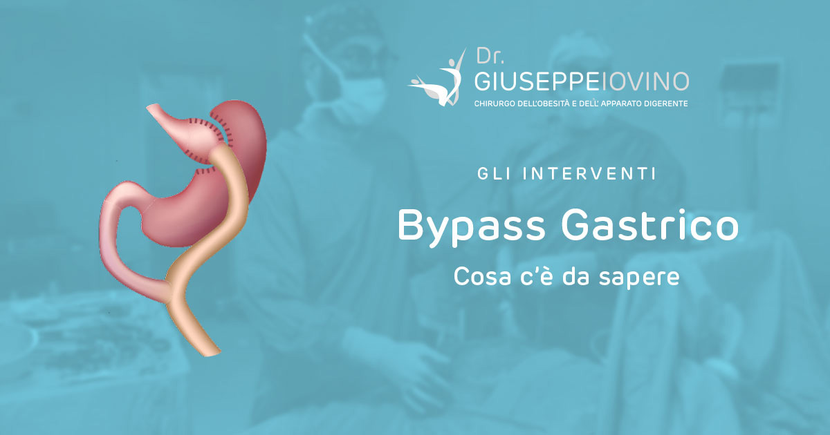 bypass-gastrico-come-funziona-dott-giuseppe-iovino-bariatrica-1