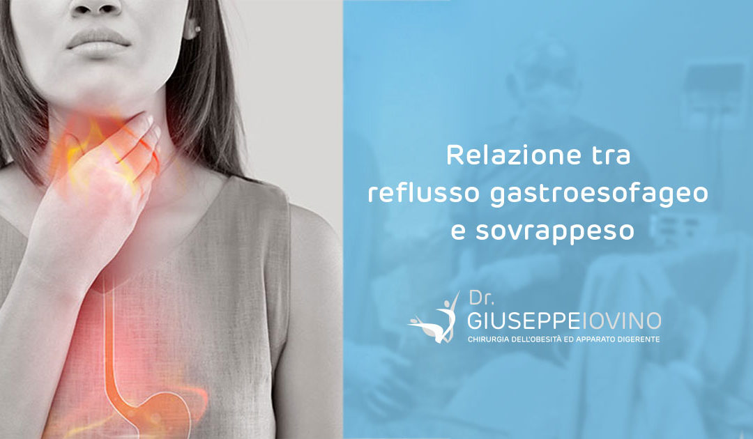 Relazione tra reflusso gastroesofageo e sovrappeso