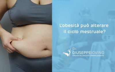 L’obesità può alterare il ciclo mestruale?
