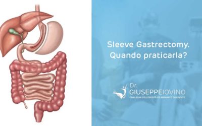 Sleeve Gastrectomy: quando praticarla?
