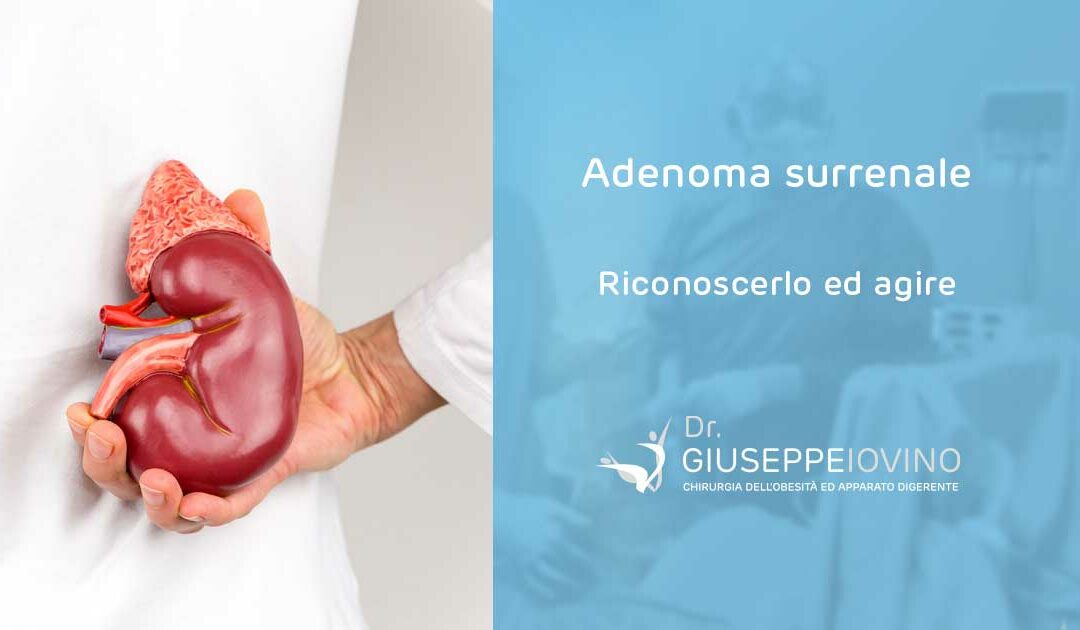 Adenoma surrenale quando operare