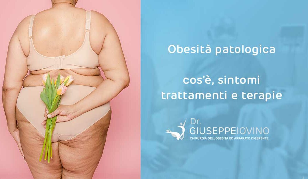 Obesità patologica: che cos’è, sintomi e trattamento