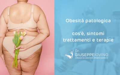 Obesità patologica: che cos’è, sintomi e trattamento
