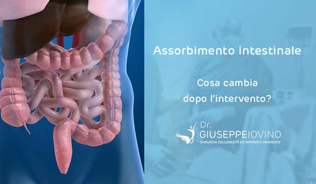 Assorbimento intestinale: cambia dopo l’intervento?