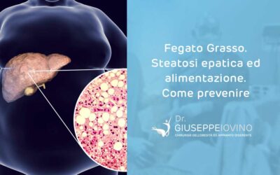 Steatosi epatica alimentazione: come prevenire il fegato grasso