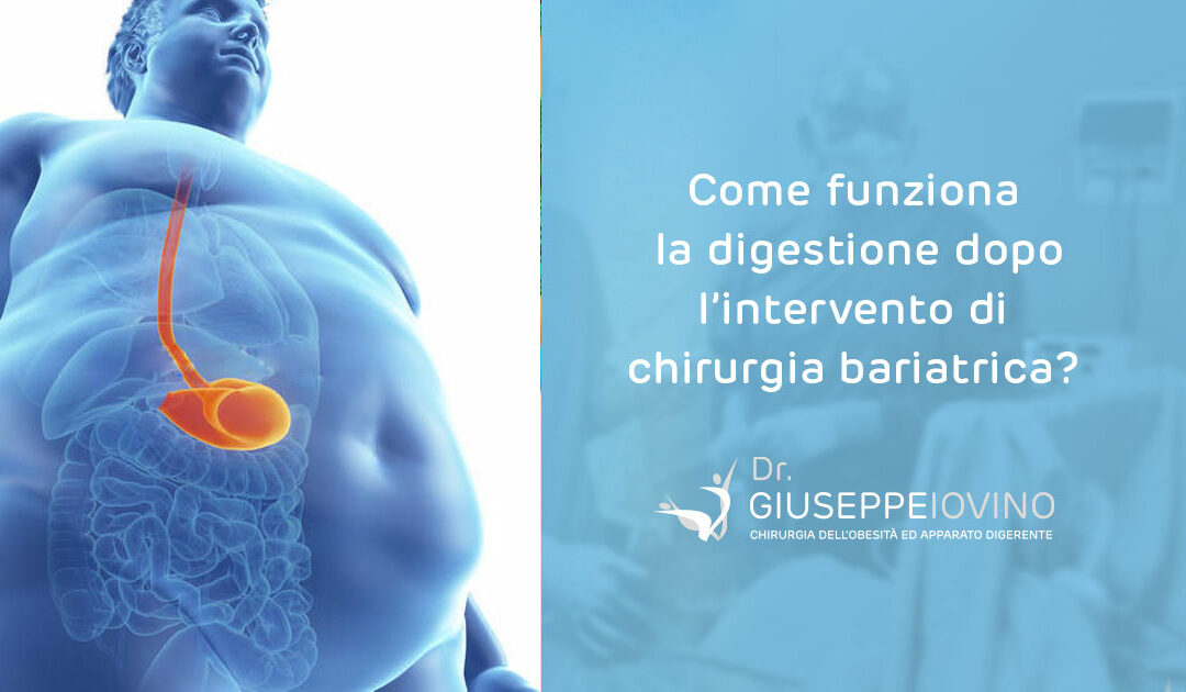 Come funziona la digestione dopo l’intervento di chirurgia bariatrica