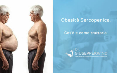 Obesità sarcopenica cos’è e come trattarla