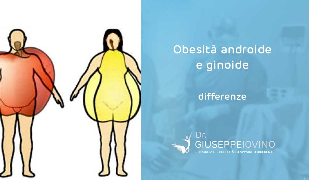 Qual è la differenza tra obesità androide e ginoide?