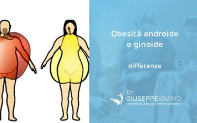 Qual è la differenza tra obesità androide e ginoide?