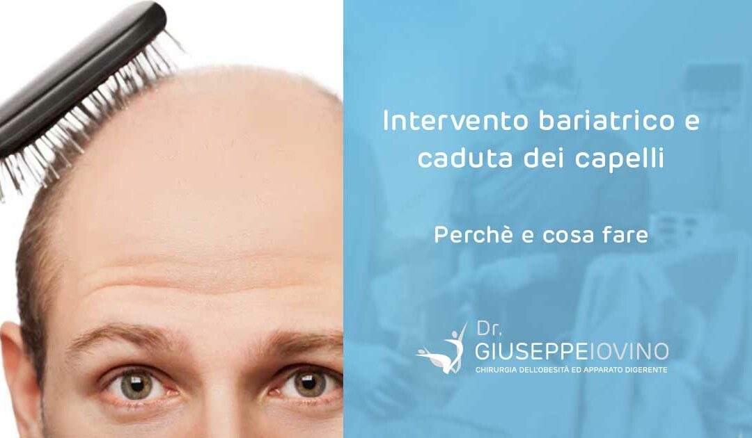 Intervento bariatrico e caduta capelli: perché e cosa fare