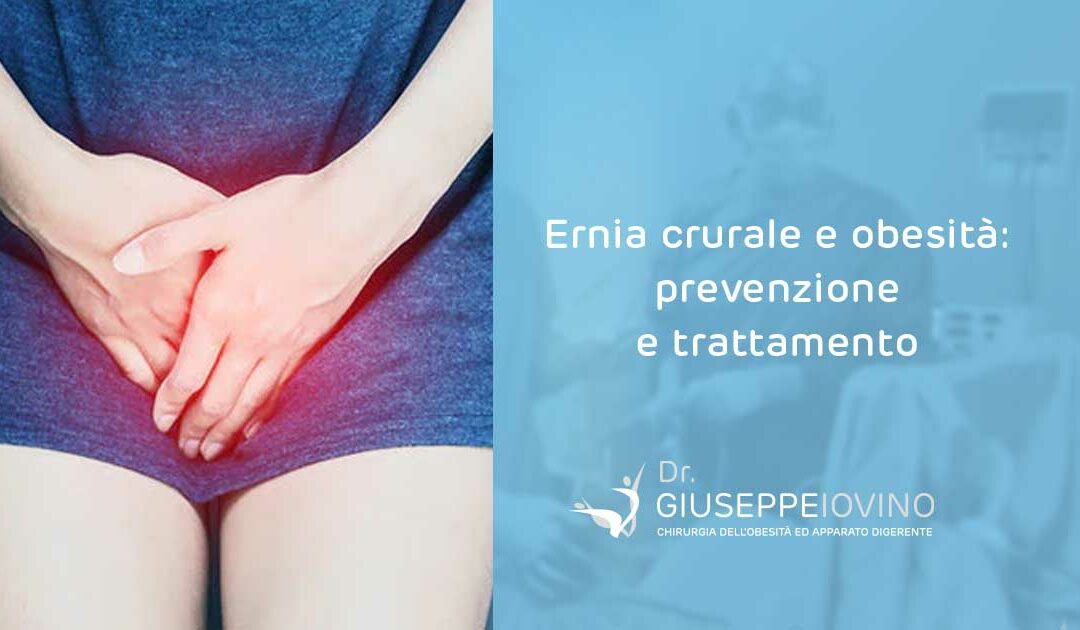 Ernia crurale e obesità: prevenzione e trattamento