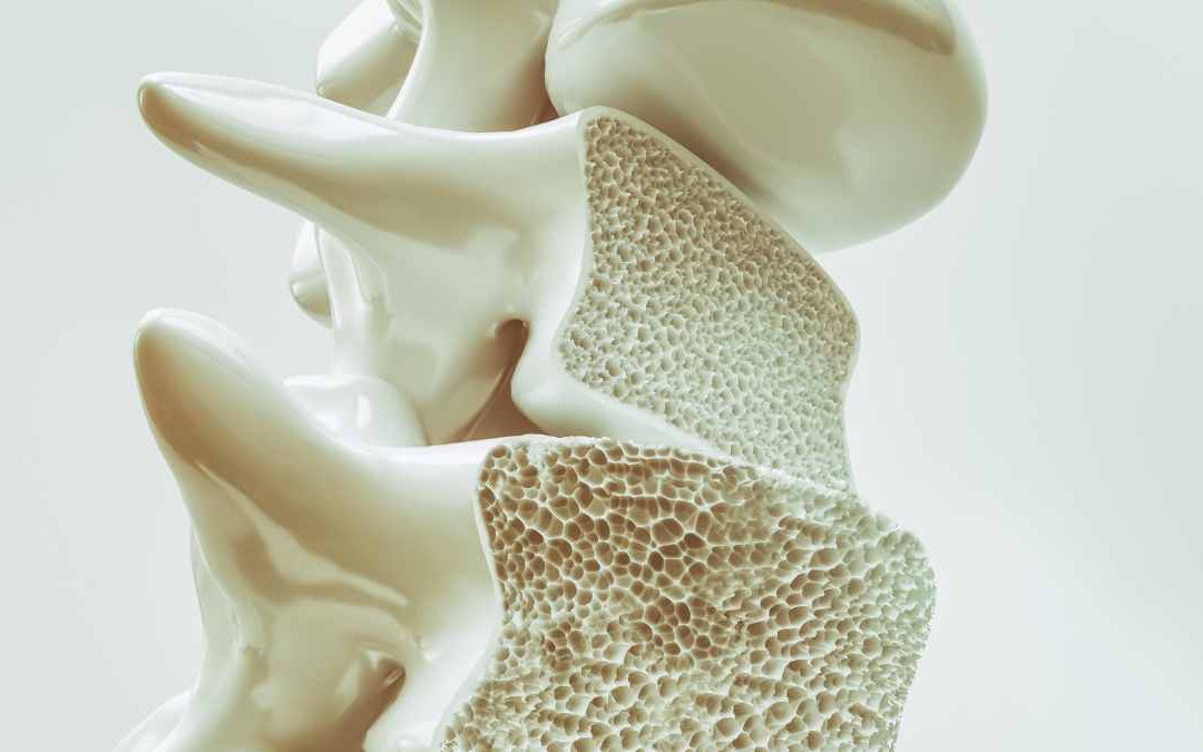 Il legame tra osteoporosi e peso corporeo: come proteggere le tue ossa