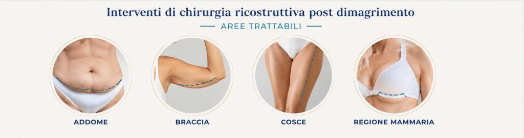 Zone del corpo trattate con chirurgia plastica post bariatrica: addome, braccia, cosce, regione mammaria