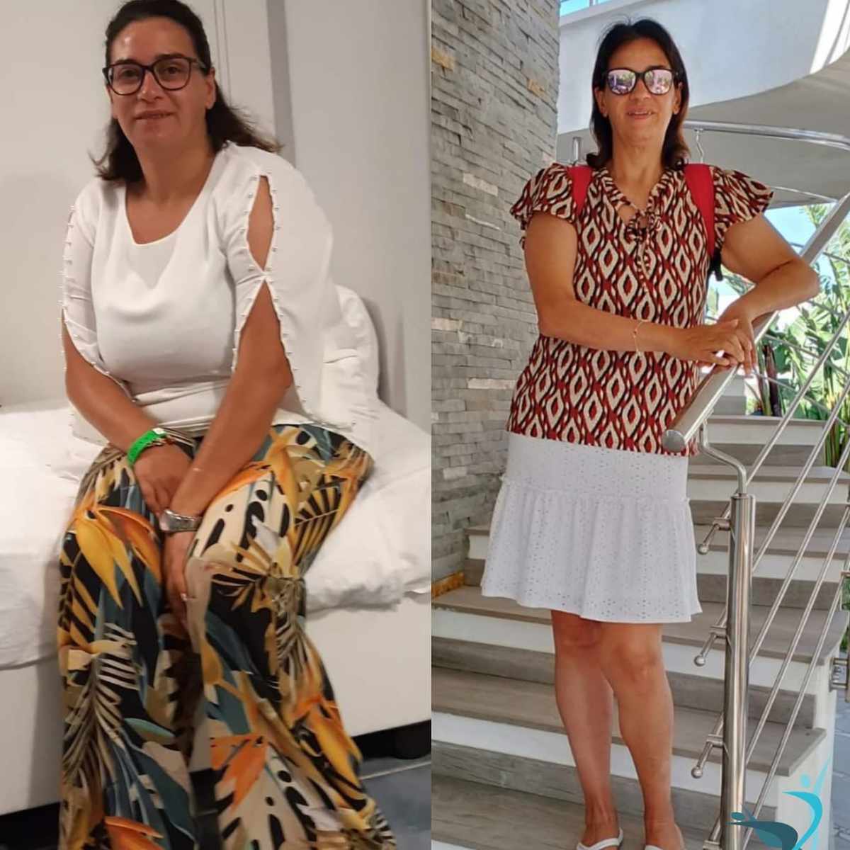 5 paziente rinata grazie al perscorso bariatrico con il dott Giuseppe Iovino