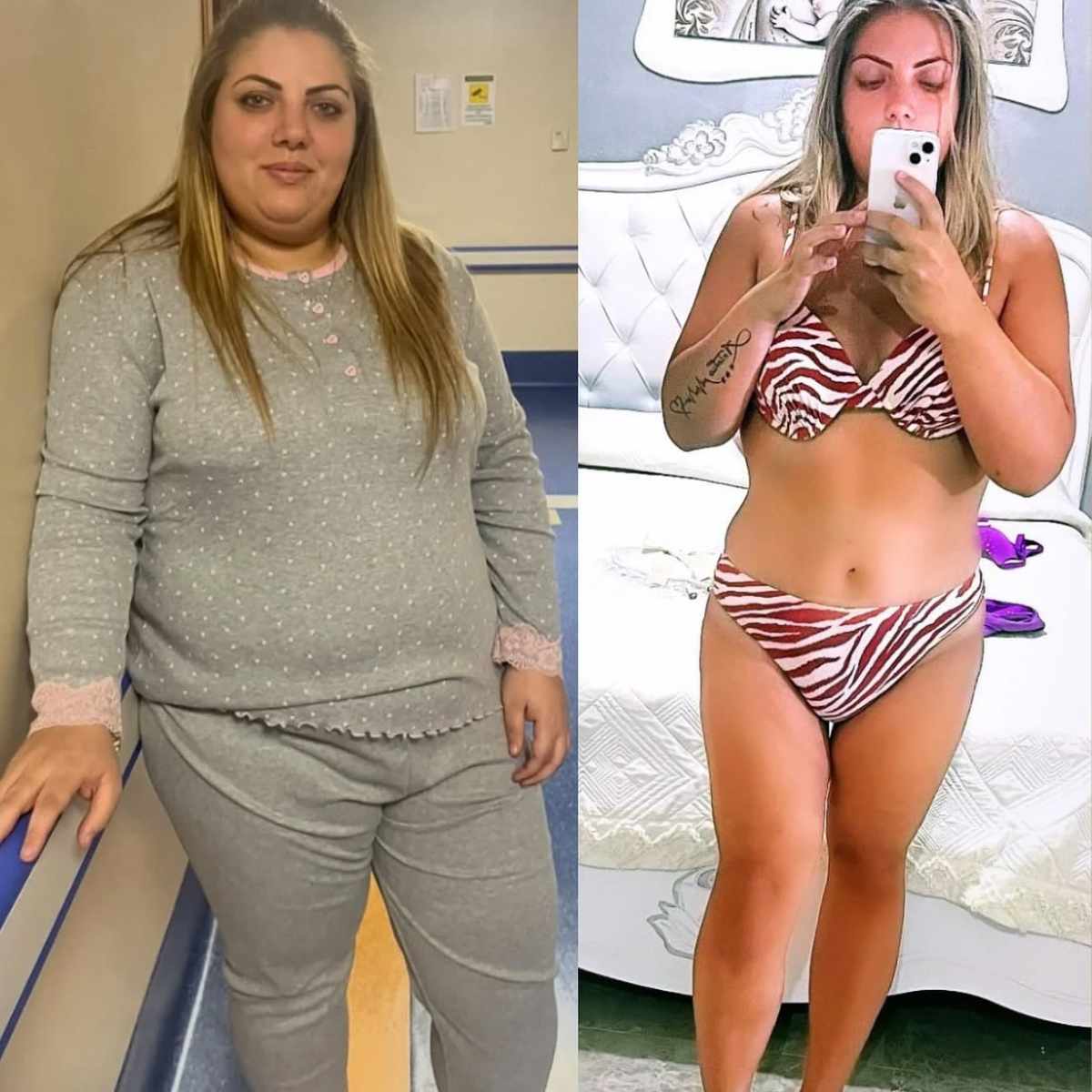 7 -26kg in 3 mesi paziente rinata grazie al perscorso bariatrico con il dott Giuseppe Iovino