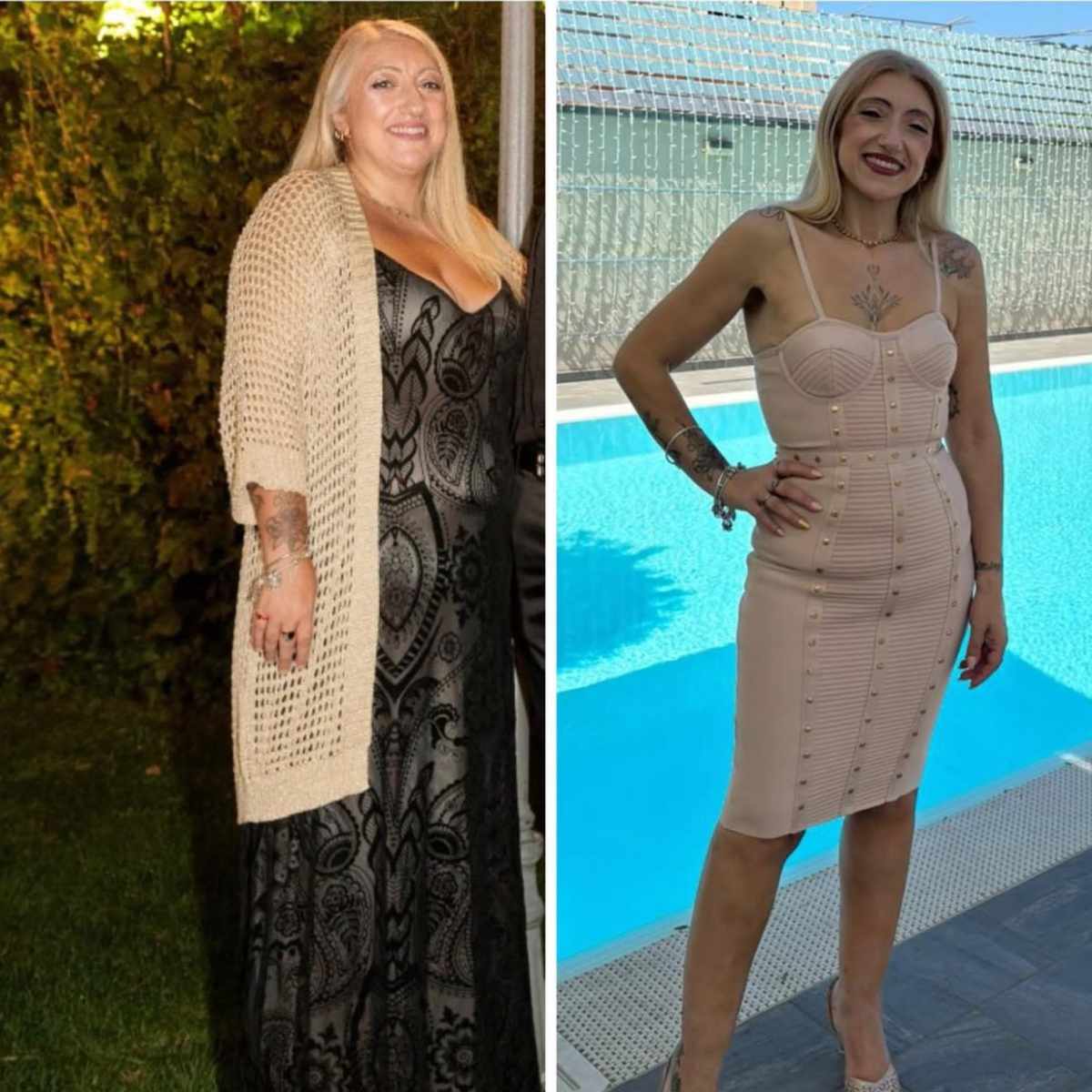 8 -45 kg in 12 mesi paziente rinata grazie al perscorso bariatrico con il dott Giuseppe Iovino